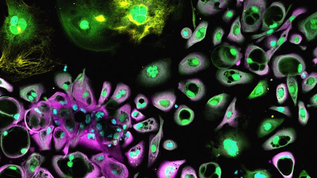cells in green and purple and black background under microscope