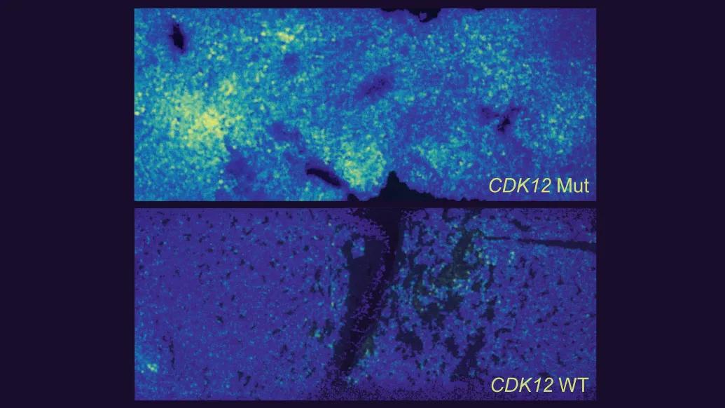 close up of microscope image lighter blue up top looks to be glowing and lower not glowing and more black