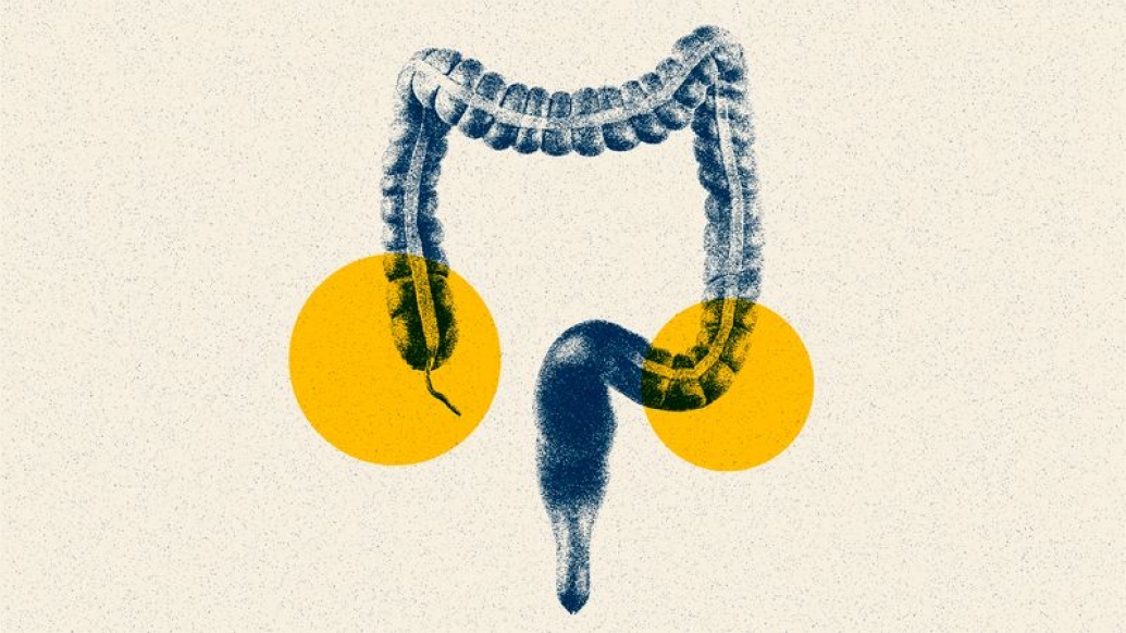 stomach intestine yellow spots navy blue