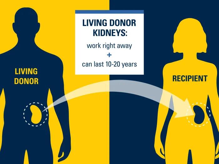 living donor kidneys two people in blue and yellow colors silhouette swapping kidneys 