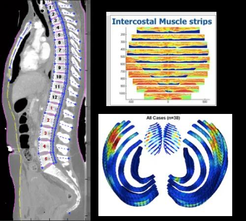 Computational Biomechanics