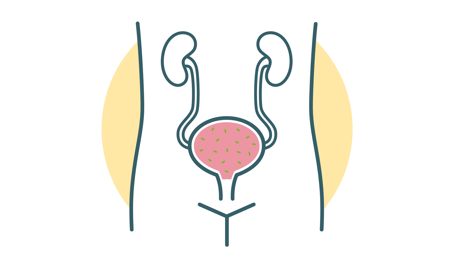 bladder full and then drained moving graphic