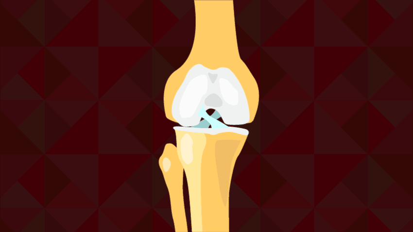 Knee tear ACL