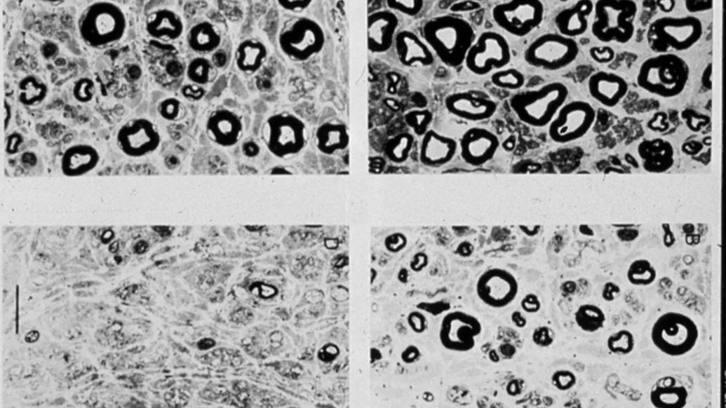 a photo of myelinated axons