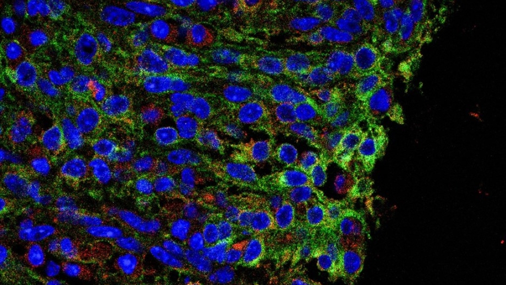 Immunofluorescence staining for ACSL4 (red), PDGFRα (green) and Hoechst (blue) in colon tissue from IBD mouse model.