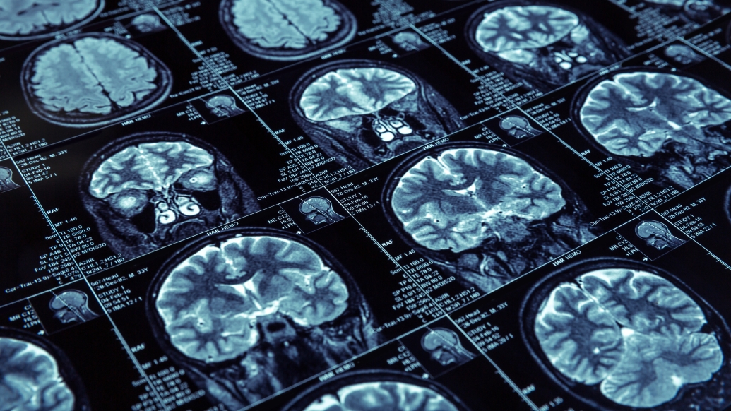 a contact sheet of various brain scans shown at an angle