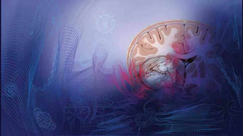 An illustration of the inside of a skull with the brain in color