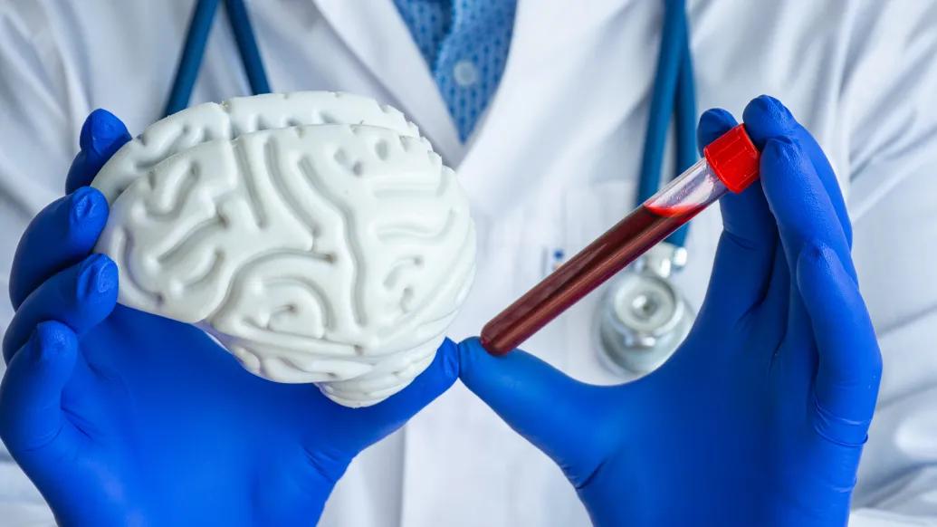 Close-up of a clinician holding a foam model of a brain and a vial with a blood sample