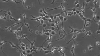 human_cortical_stem_cells_in_culture_1_copy