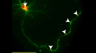 image shows vascular endothelial growth factor receptor activation (arrows, yellow) in a motor neuron