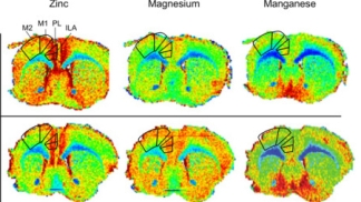 metals measured in a preclinical model brain