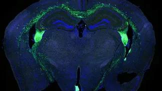 stem cells (green) that have been transplanted into a preclinical model brain (blue).