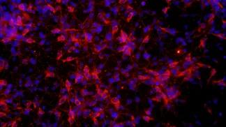 brain nerve cells derived from stem cells shown in red