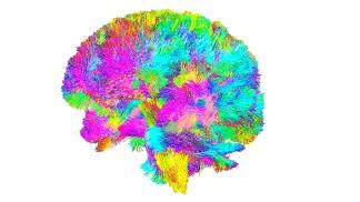 brain tractography showing different nerve tracts in a human brain denoted in different colors