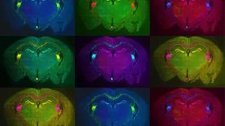 colored imaging of stem cells transplanted into animal model brains