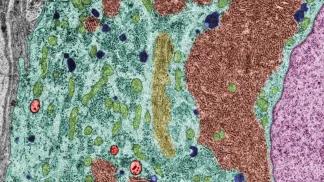 cytoplasm of a neuron