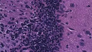 stem cells shown as dark spots that have been transplanted into an animal model brain
