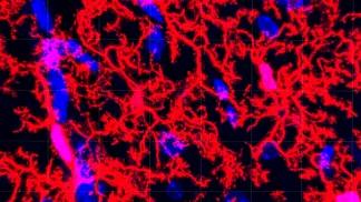 microglia