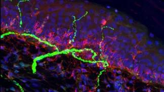 nerve fiber shown in green that was damaged from diabetes