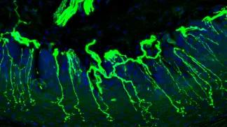 nerve fibers shown in green in an image taking from an animal model