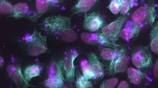 stem cells
