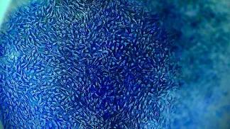 a group of Schwann cells