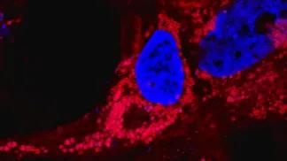 extracellular vesicles surrounding a nucleus