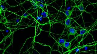 tau protein (blue) in neurons (green).