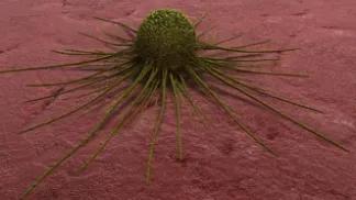 Radioactive antibody to fight cancer