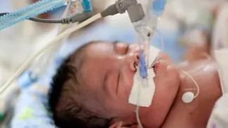 Baby using ECMO