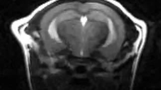 imaging of a mouse brain