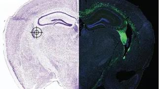 a slice of the hippocampus with half of it showing stem cells transplanted into it