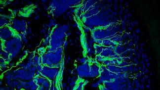 imaging that shows nerve fibers in green
