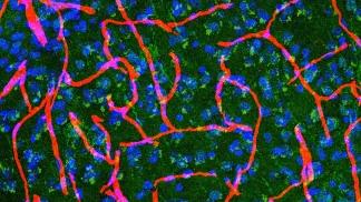 Microscopic image of a mouse brain stained to show neuron nuclei in blue, proteins in green and blood vessels in red.