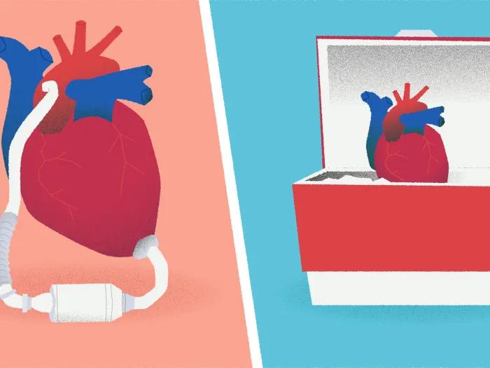 VAD heart device cooler red and teal