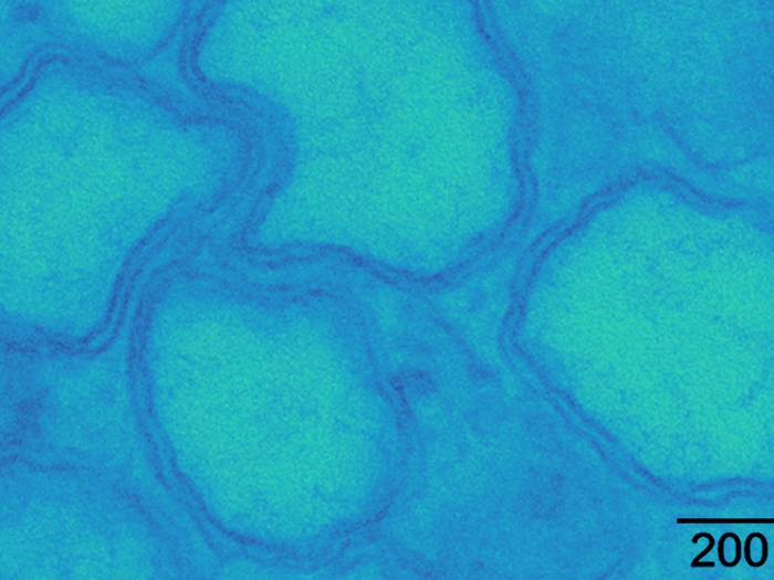 blue cells