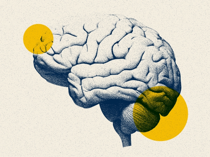 brain image