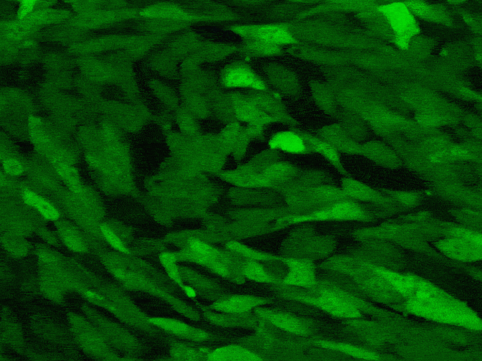 Animated microscopic image of the glioblastoma's tumor microenvironment