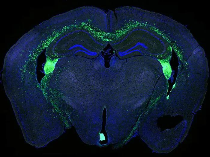 photo of stem cells transplanted into an animal model brain