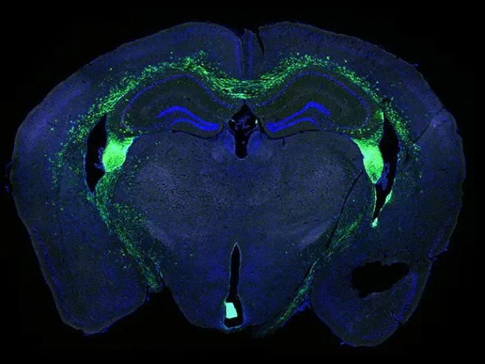 stem cells (green) that have been transplanted into a preclinical model brain (blue).