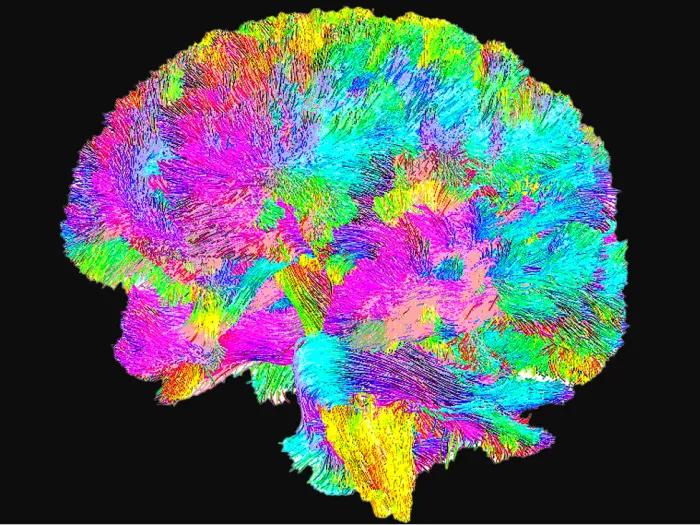 imaging showing brain tractography in different colors