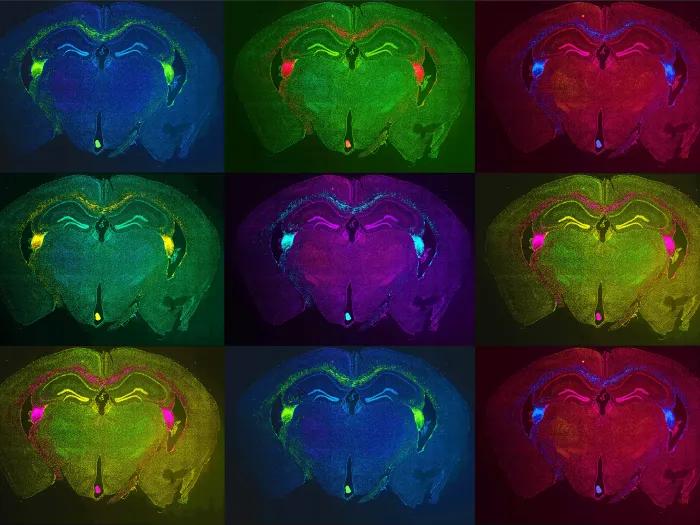 colored imaging of stem cells transplanted into animal model brains