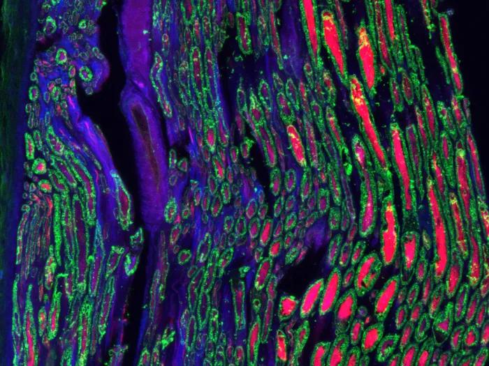 nerve axons shown in red, myelin shown in green and inflammatory markers in blue