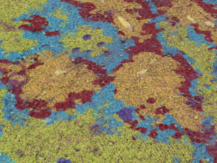yellow blue maroon close up image of cells