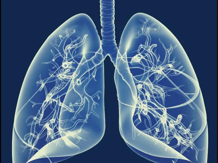 breaking new ground in COPD transparent lungs