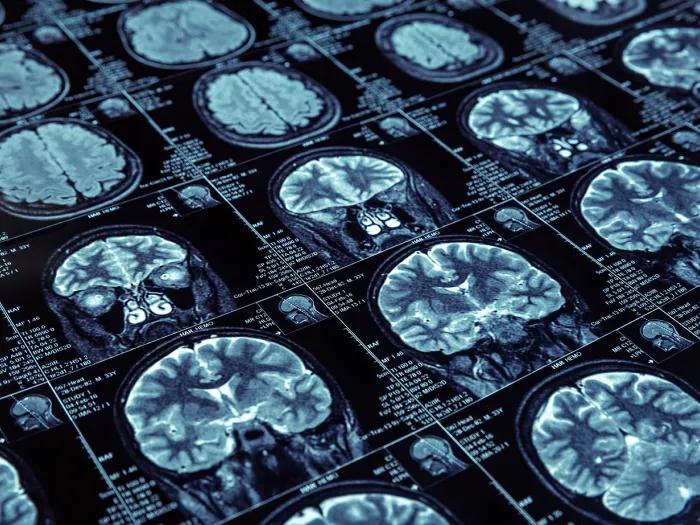 dementia for scientists curriculum