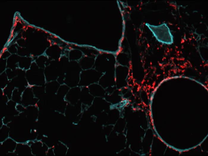 Microscopic view of lung cells: The lungs are patrolled by specialized adaptive immune cells called CD4+ T cells that constantly interact with distinct lung epithelial cells to ensure our lungs are protected from pathogens.