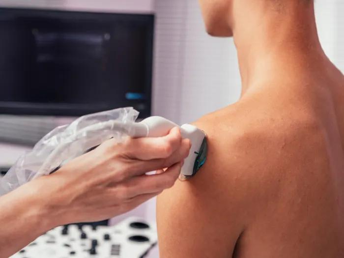 ultrasound on skin 