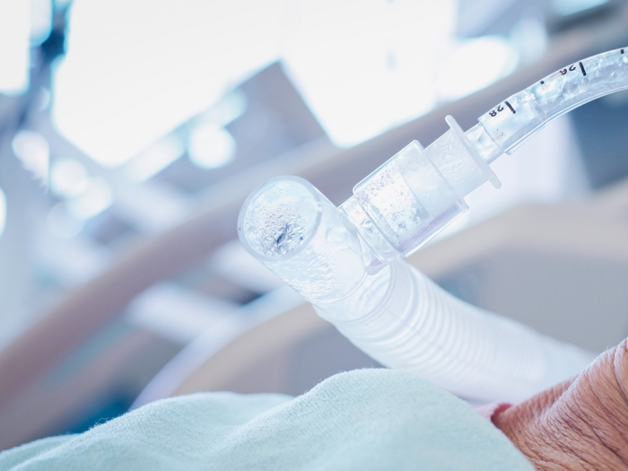 breathing tube in patient close up in hospital bed