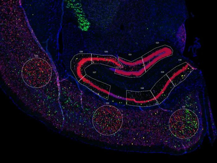 transcriptonomics of a mouse hippocampus